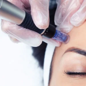 DERMAPEN CON MESO